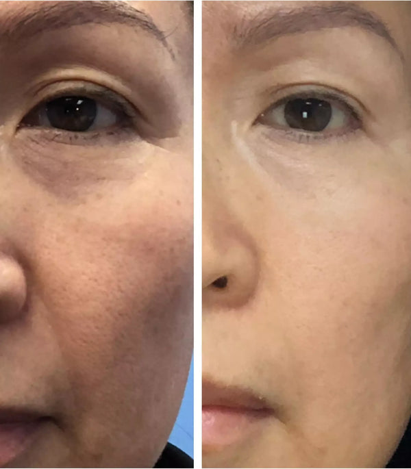 Sleep & Renew Super Serum